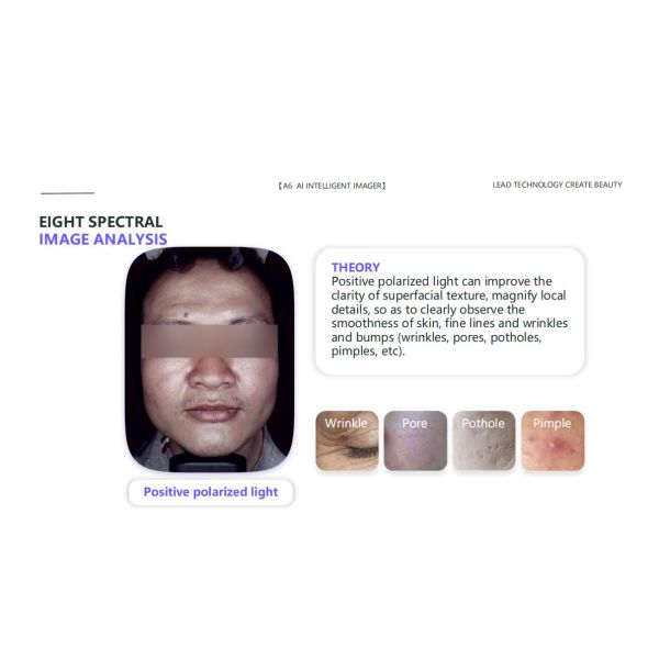 GMS- A6 Al Intelligent Face Analyzer Machine 8 Spectral Imaging Technologies for One Click Analysis of 15 Skin Problems
