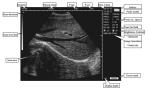 CLS5800 laptop Veterinary Ultrasound Scanner Full Digital Ultrasonic Diagnostic
