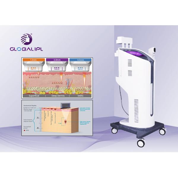 4D Wrinkle Removal HIFU Machine 4 - 7MHz Frequency With Better Curative Effect