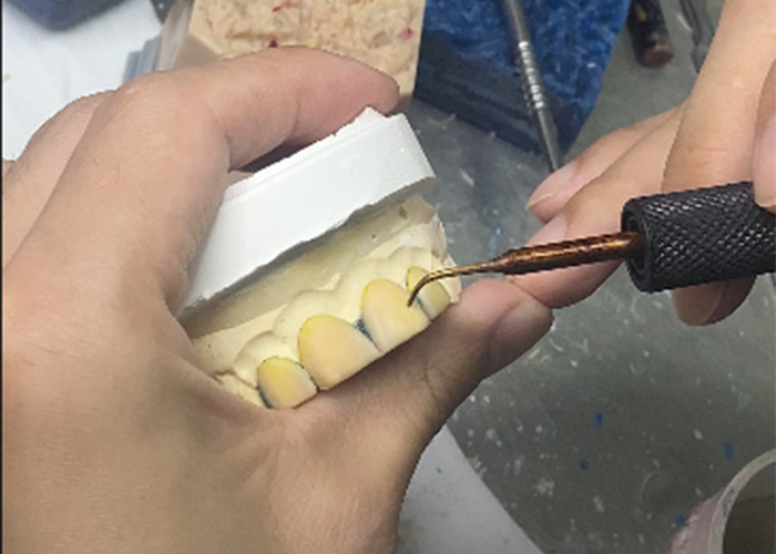 Precision Fitted Dental EMAX Veneer Natural Looking for Esthetic Restorations