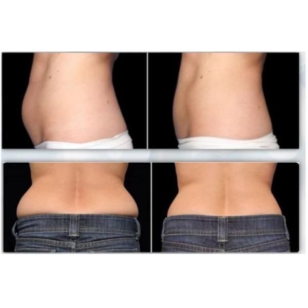 Vertical Cryolipolysis Slimming Machine , 4 - Handle Type Fat Reduction Equipment