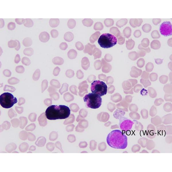 Baso Leukocyte Peroxidase Stain Pox Stain Oxidation WG-KI Method