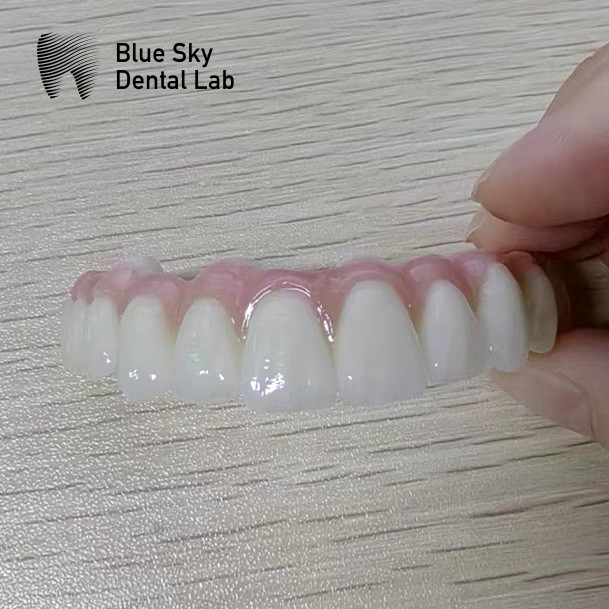 Blue Sky Nature Dental Implant Case Multiple Choices Implant System