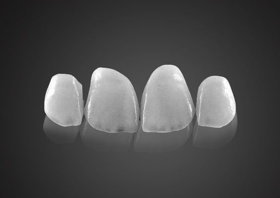 IPS 0.2mm Ultra Thin Emax Veneers Stain Resistant With High Strength