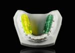 Colorful Gelb Dental Splint Hard Acrylic Resin Occlusal Splint For Nighttime