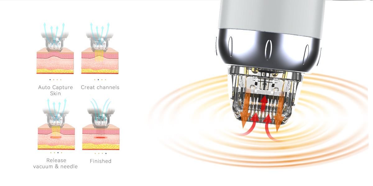 High Quality Acne Removal Microneedling Radio Frequency Rf Microneedling Vacuum Rf Microneedle Machine