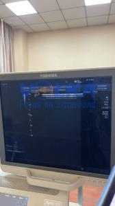 China Canon Toshiba Aplio 50 SSA-700A Linear Vascular Ultrasound Probe PLT-704AT wholesale