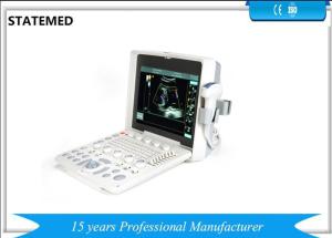 China Color Doppler B Ultrasound Machine Ultrasonography Machine With 2 USB Ports wholesale