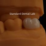 5-Year Guarantee Full Contour Zirconia Crown for Molar Teeth Noritake Porcelain