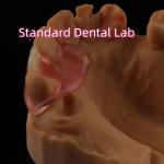 Dental TCS Valplast Flexible Partial Dentures Nesbit Valplast Finish China