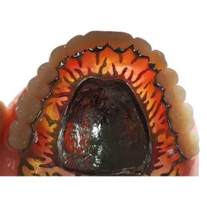 China Full Removable FDA 3014652903 Composite Resin Crown Denture Teeth wholesale