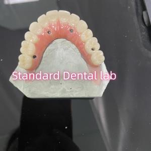China All On Four Six Ivoclar Zirconia Implant Bridge TItanium Bar With Pink Gum Porcelain wholesale