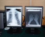 Eco Friendly Gray Scale Medical Grade Displays Energy Saving For DR