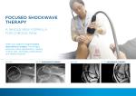 Physical Therapy Physiotherapy Pain Treatment Eswt Shock Wave Dual Handles