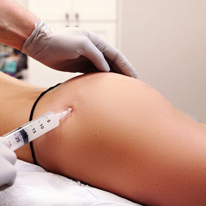 50ml 100ml Dermal Fillers For Breast Butt injection Buttocks Augmentation with Hyaluronic Acid