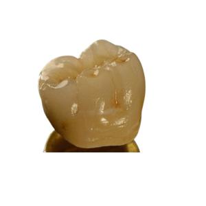 China Inter Miscibility Porcelain Dental Crown wholesale