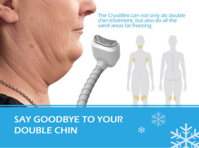 hot sale 4 together working handles cryolipolysis body slimming machine