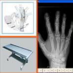 High Frequency Digital U-Arm X-Ray System 50kw CE For Hospital