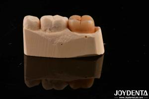 China Dental Restoration Material Multilayer Full Zirconia 1200 HV Hardness Crack Resistance wholesale