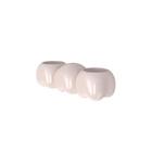 China Porcelain Dental Crown Porcelain Dental Bridge For Natural-Looking Results wholesale