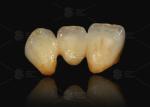 A3 A3.5 Porcelain Fused To Metal Co Cr And Ceramic Dental Crown PFM Cad Cam