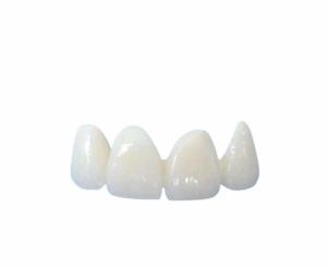 China Easy Cleaning All Ceramic Crowns Transparent Natural Shade Customizable wholesale
