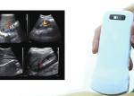 Home Doppler Ultrasound Portable Diagnostic Hand held Doppler Ultrasound