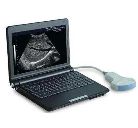 2.5-8.5MHz Diagnostic Ultrasound Equipment / 256 Levels Tablet Ultrasound