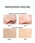 Portable Ultrasonic Skin Scrubber Pores Cleansing Anti Aging Instrument
