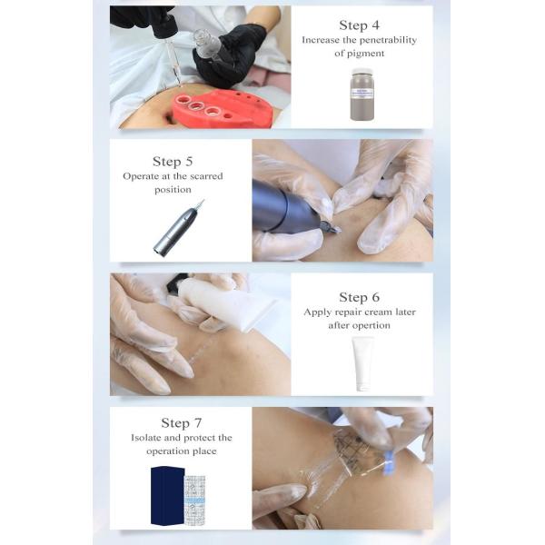 ODM 15ml Permanent Makeup Pigments Remove Skin Care Products