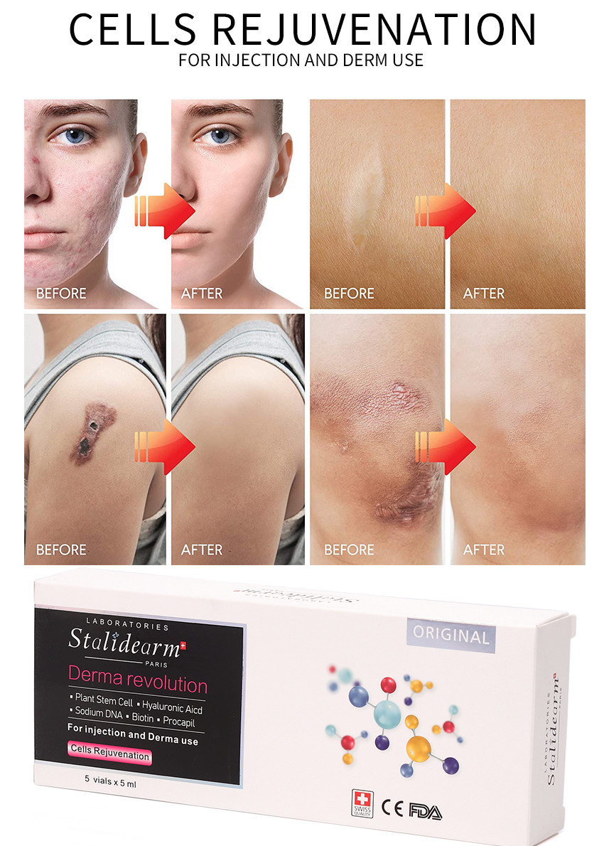 Cells Rejuvenation Serum Anti-Aging essence injection use serum set 5pcs/set Supports Skin Hydration & Firmness