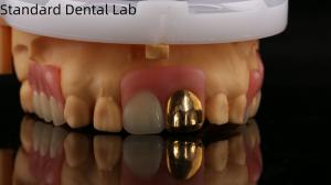China Full Acrylic Dentures With Yellow Gold Teeth/Dental Temporary Acrylic Denture Ivoclar Professional FDA Approved wholesale