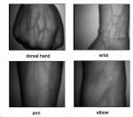 No Laser Reducing Venipuncture Failure Infrared Vein Finder Vein Display