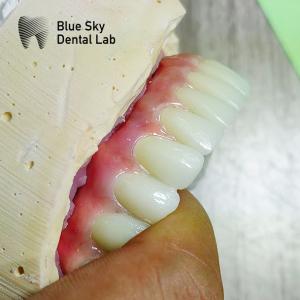 China Nature Surface Universal Compatible Multiple Choices Implant operation cases for Steam Sterilization wholesale