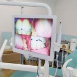 Wifi All In One Oral Camera With Loudspeaker LCD Screen Dental Oral Camera