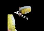 Custom Translucent Zirconia dental Crowns Crafted by AMD Dental Lab