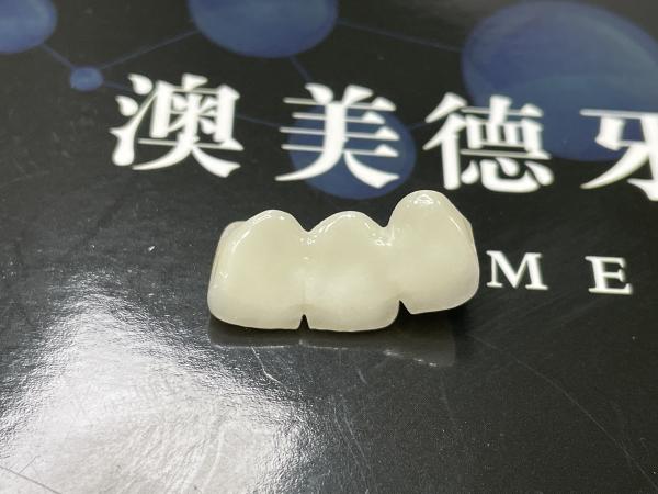 Precise Fit Ceramic Crown Bridge with Strong Porcelain and Natural Aesthetic