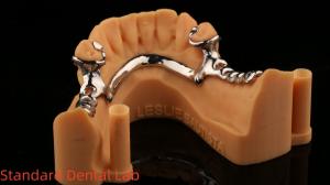 China Metal Alloys Partial Cobalt Chrome Dentures Ivoclar Scheftner Comfortable China Dental Lab wholesale