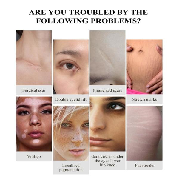 ODM 15ml Permanent Makeup Pigments Remove Skin Care Products