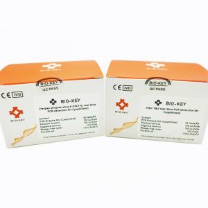 China Herpes Simplex Virus 6 HSV-6 96tests/Kit Real Time PCR Detection Kit Lyophilized wholesale