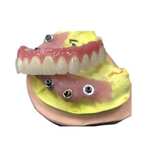 China Implant Abutment Zirconia Dental Crown Natural All On Four Dentures wholesale