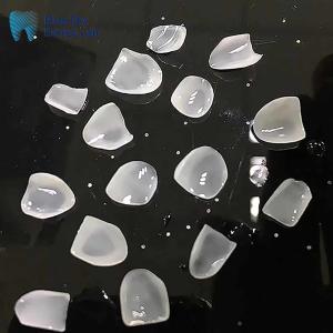 China Ultrathin E Max Veneers Ingot Class Ceramic Natural Looking Veneers wholesale