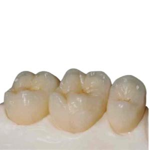 China High Strength Zirconia Ceramic Teeth Precision Digitally Manufactured wholesale