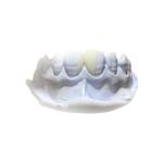 Efficient Resin Removable PFM Dental Crown Health Materials