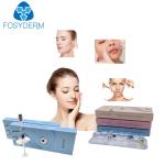 Chin Nose Up 2ml Hyaluronic Acid Dermal Filler With Lidocaine