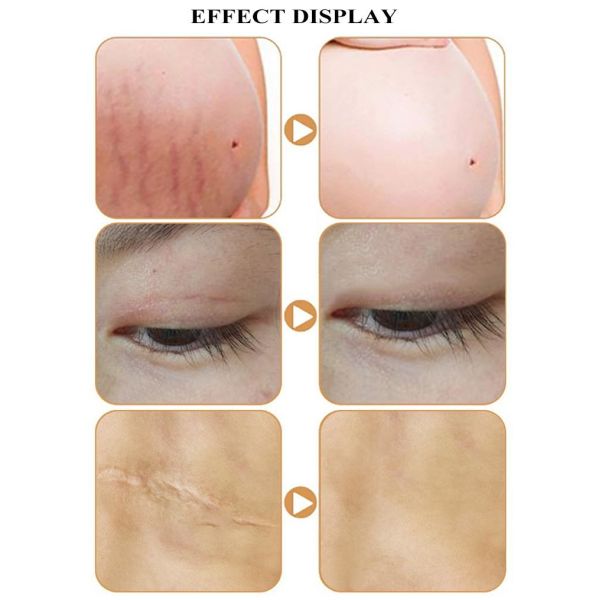 ODM 15ml Permanent Makeup Pigments Remove Skin Care Products