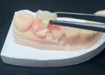 Emax Ceramic Inlays Onlays Dental Restorations For Natural Tooth Color And Easy