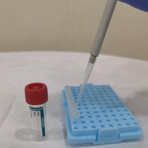 China Sample Release Kit Flocked Swab RNA Preservation and Extraction Tube Directly on PCR Amplification on sale