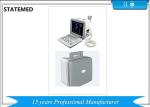 Clear Images Portable Ultrasound Scanner Machine For Hospital Easy Operation