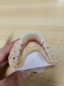 China Elevating Standards Our Dental Implant Crown Quality Assurance wholesale